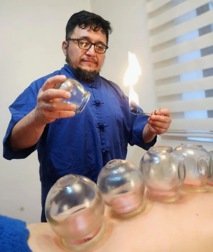 Docente preparando ventosas de fuego con algodón encendido junto a una fila de copas ya aplicadas.
